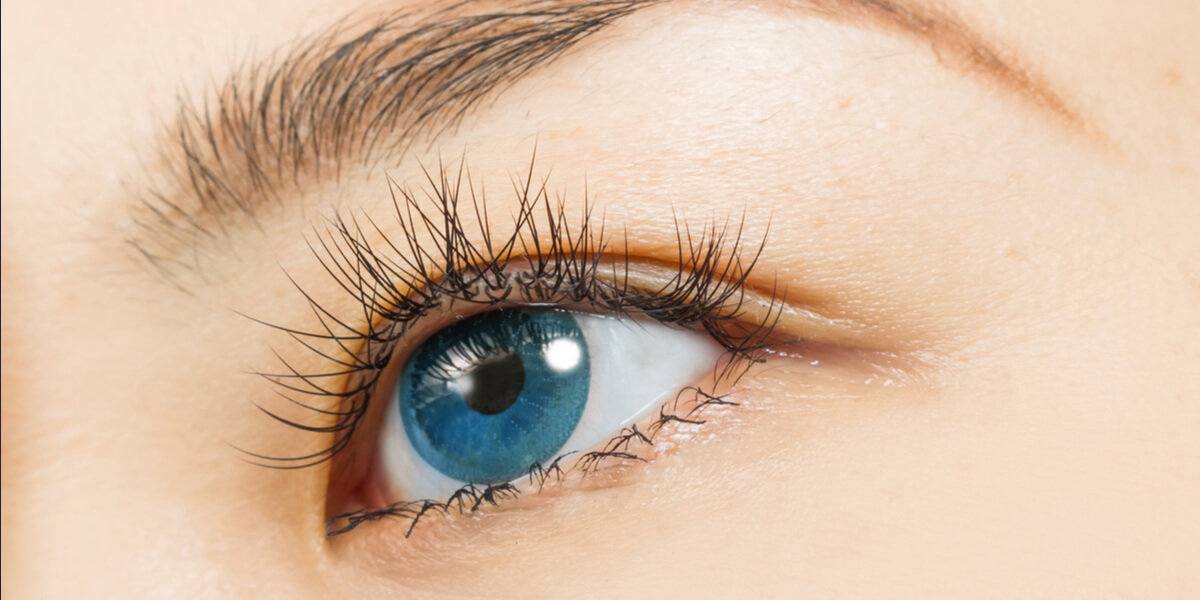 göz damarları , retina dekolmanı