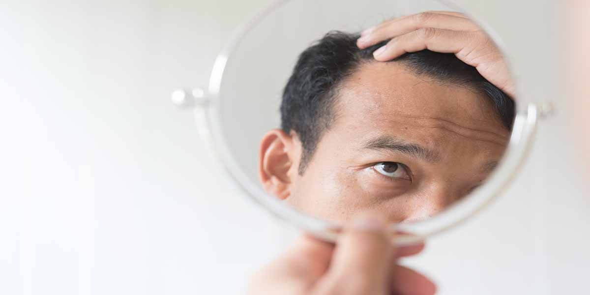 Şok Diyetler Saç Kaybına Neden Olabilir